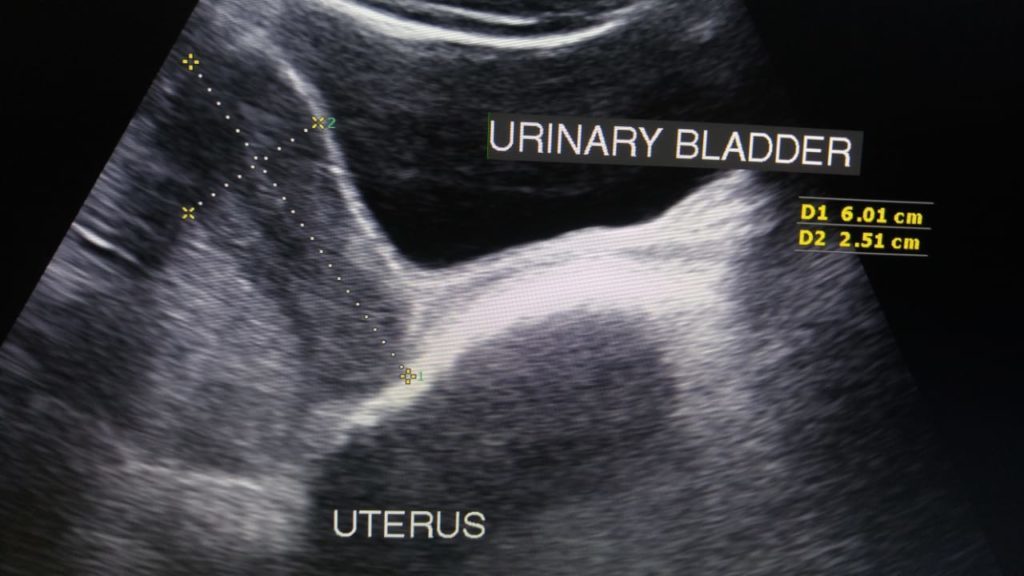 Abdominal Sonography | Sono Scan 5D